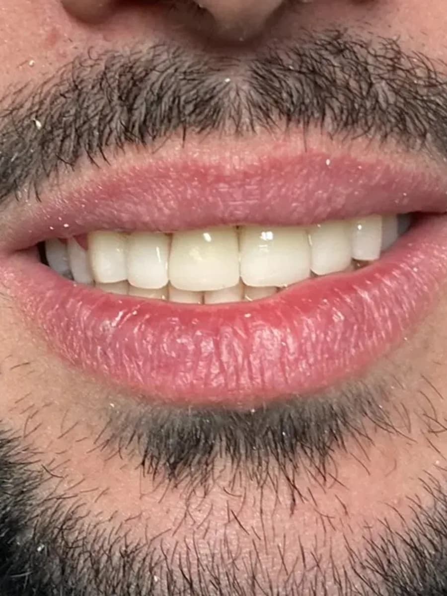 Facetas